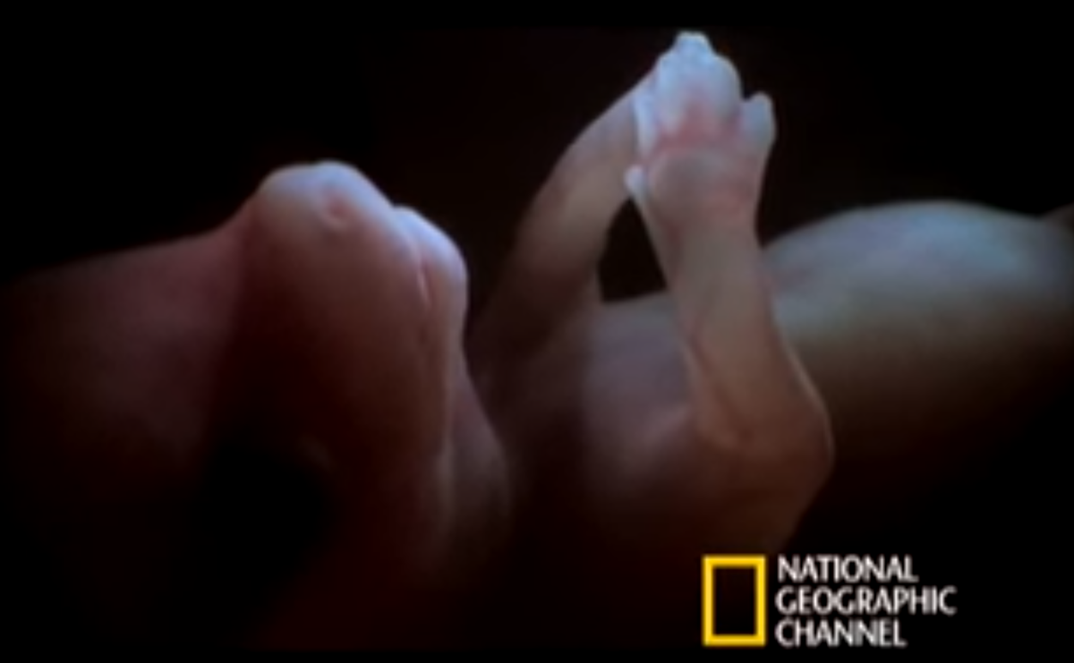 This is What a Dog Fetus Looks Like